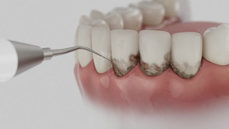 Reliable Dental contractor in Angels, CA by Dentist Open Now